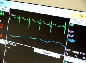 Kleinstes EKG weltweit: Mini-EKG rettet Menschenleben