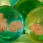 Trisomie-Bluttest immer noch in Kritik: Entscheidungshilfe für Schwangere oder doch Diskriminierung von behinderten Menschen? Trisomie-Bluttest immer noch in Kritik: Entscheidungshilfe für Schwangere oder doch Diskriminierung von behinderten Menschen?