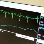 Kleinstes EKG weltweit: Mini-EKG rettet Menschenleben